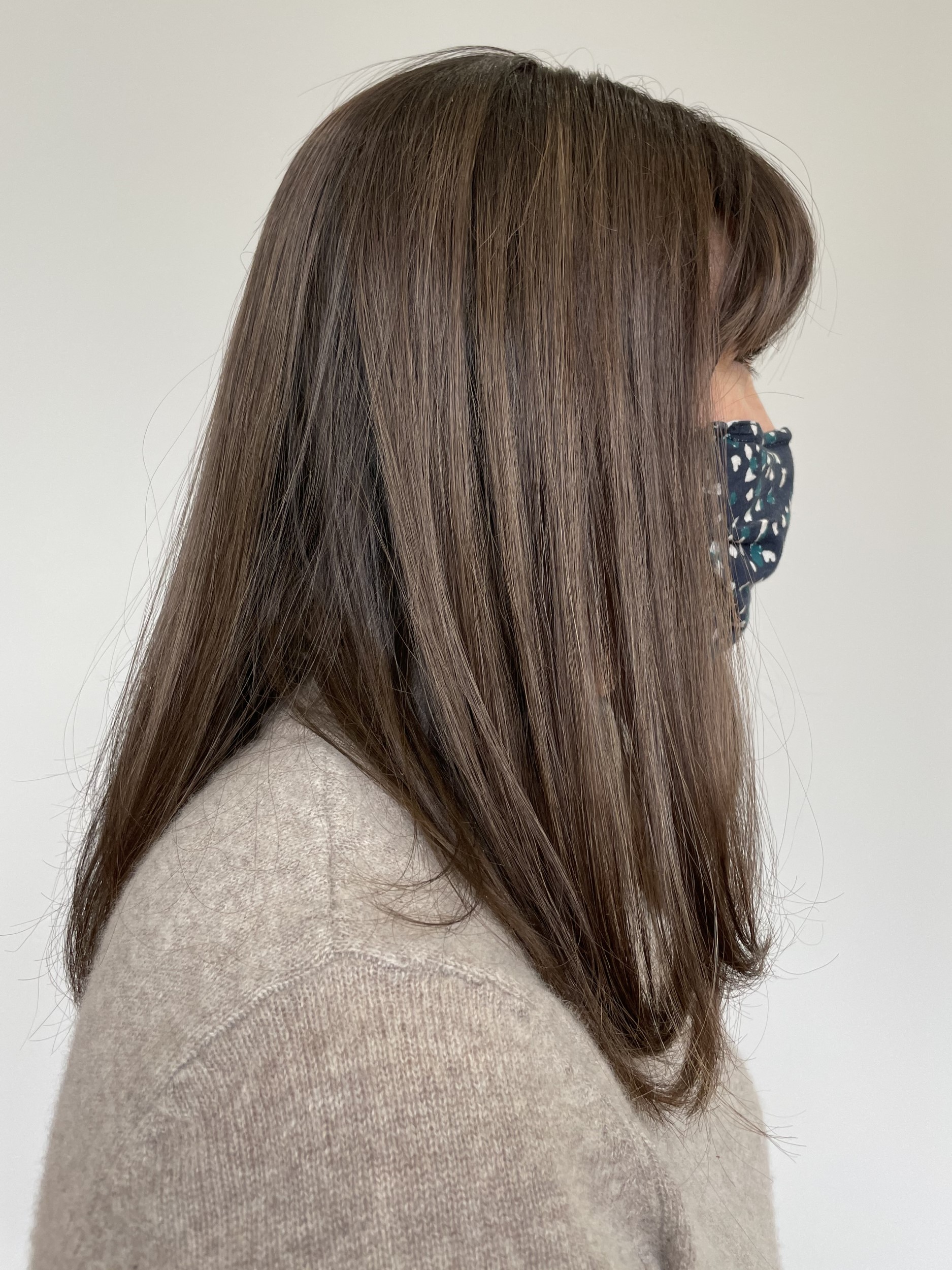 Hair Loss is an Unexpected Consequence of COVID19 Infection The